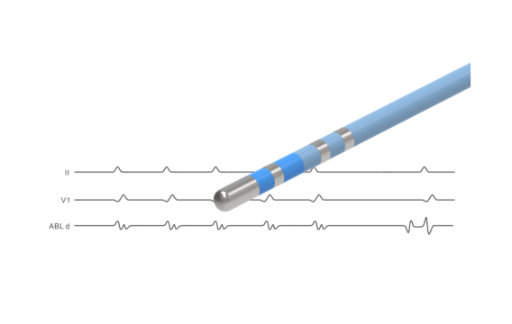 NAVABLATOR? 心臟<font color=red>射頻</font>消融導管