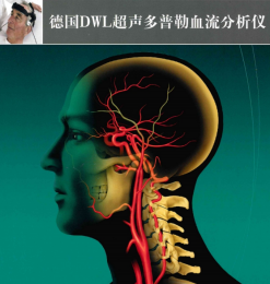 德國DWL超聲多普勒血流分析儀：功能助力腦血流評估