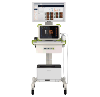 回波肝臟瞬時(shí)彈性檢測(cè)儀fibroscan Q