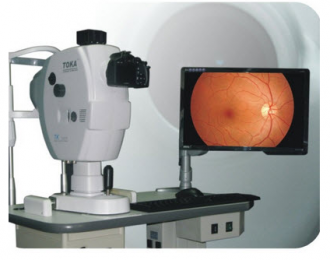  眼底照相機(jī)：深入探索眼底健康的進(jìn)工具