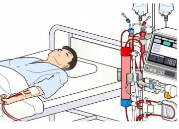 血液透析設備廠家：健康醫(yī)療領域的新潮流