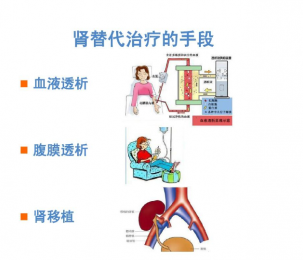 血液透析設(shè)備的價(jià)格及選購(gòu)指南 