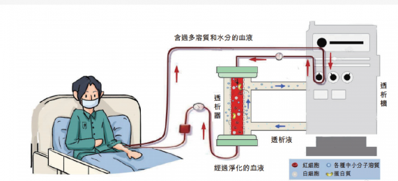 費(fèi)森尤斯血液透析機(jī)：改善生活，重塑未來