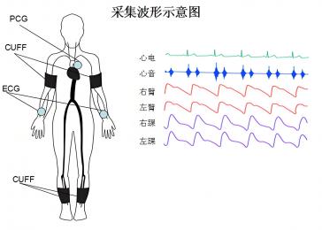 動脈硬化檢測儀的臨床意義，動脈硬化檢測儀的原理與技術(shù)！