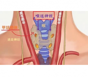 喉返神經監(jiān)測儀的優(yōu)缺點分析-甲狀腺外科設備