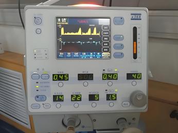 兒童呼吸機(jī)參數(shù)正常值范圍