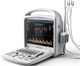 飛依諾便攜式彩超V6功能介紹-朗逸器械醫(yī)療