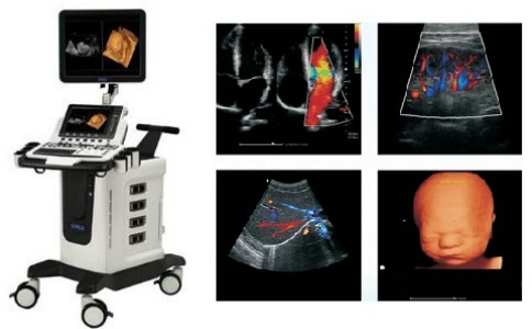時邁全數字彩色多普勒超聲診斷系統S70