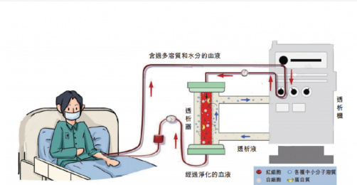 了解血液透析機的工作原理、裝置特點及應(yīng)用