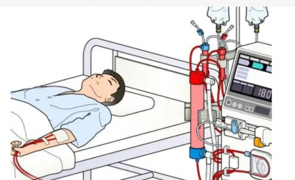 了解血液透析機器的工作原理、外觀和結構
