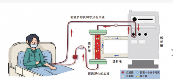 了解血液透析機的原理和結構-朗逸器械百科