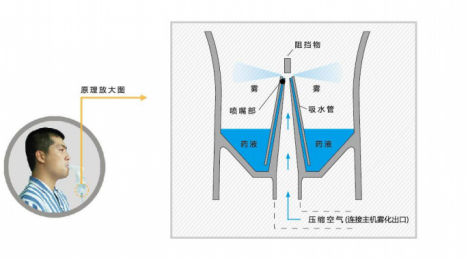 了解壓縮式霧化排痰機的主要特點及適用科室