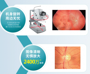 TNF506 數(shù)碼眼底照相機(jī)-高清影像質(zhì)量的專業(yè)醫(yī)療設(shè)備