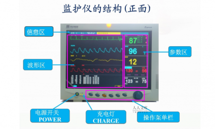 正確使用心電監護儀的技巧：保障患者安全健康